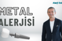 Metal Alerjisi Nedir